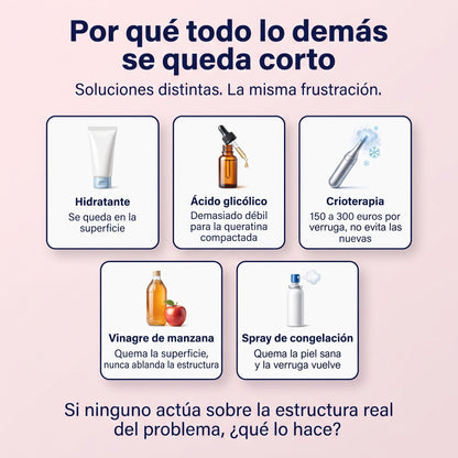 Por qué todo lo demás se queda corto