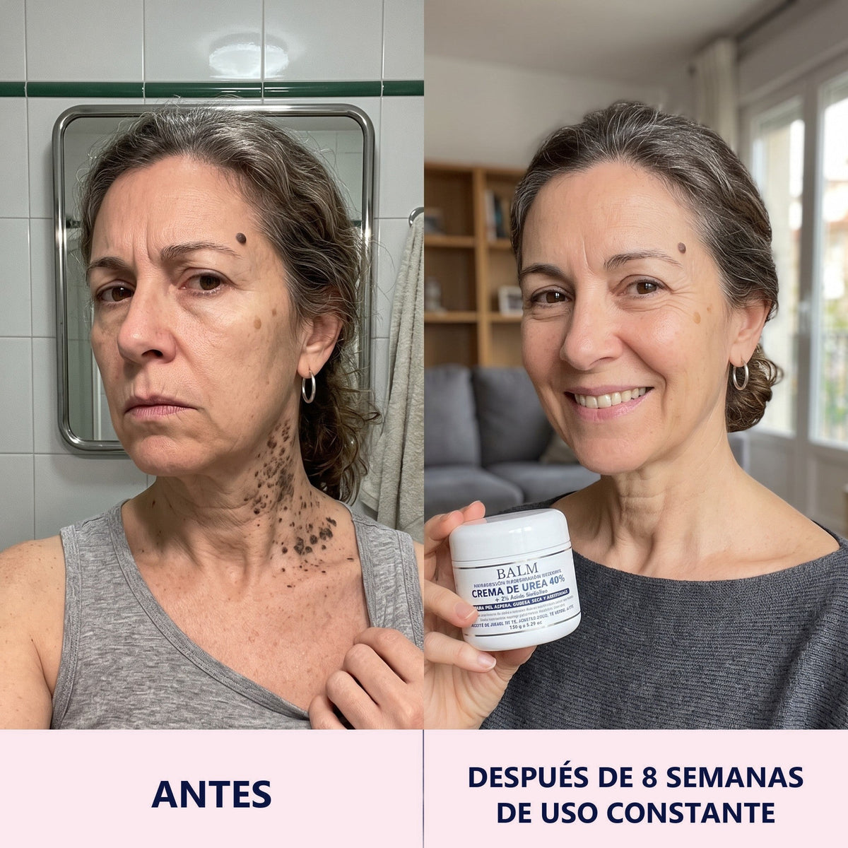 Antes y después, cuello, 8 semanas