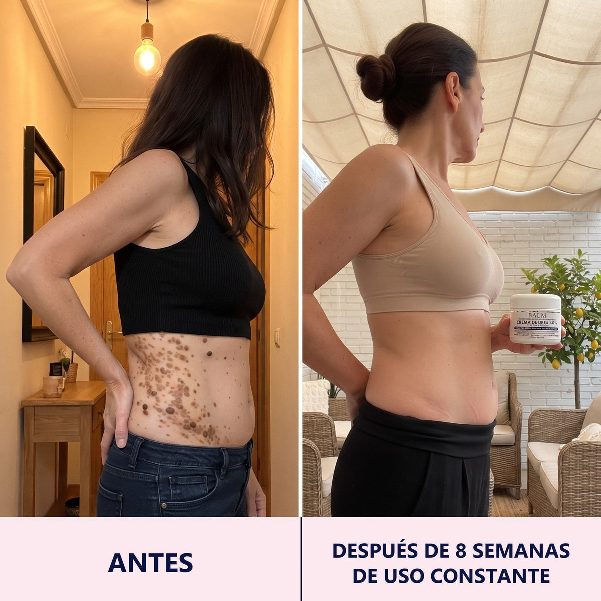 Antes y después, costado y cadera, 8 semanas