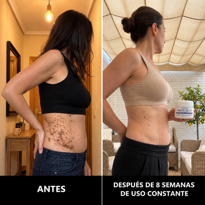 BALM — Crema Queratolítica Avanzada · Urea 40 %