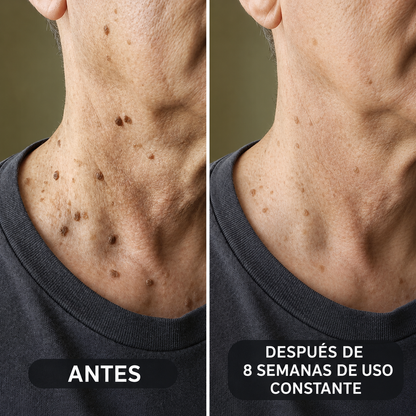 BALM — Crema Queratolítica Avanzada · Urea 40 %