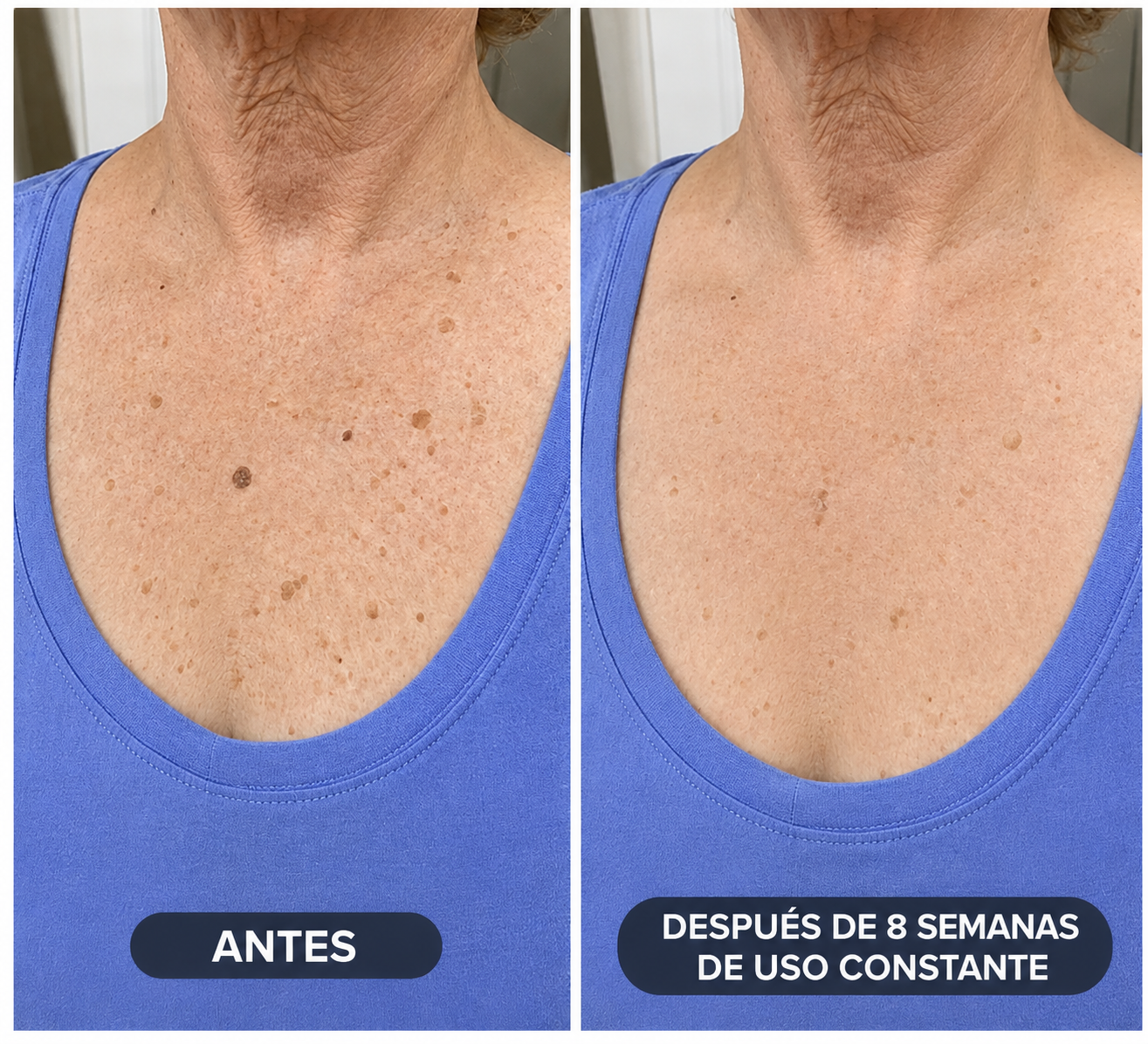 BALM — Crema Queratolítica Avanzada · Urea 40 %