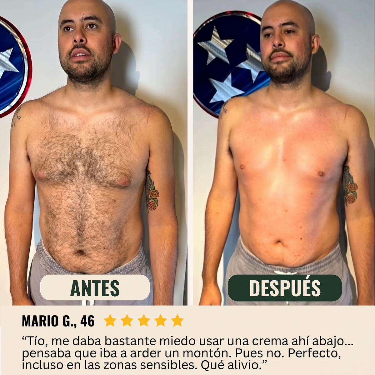 Antes y después - Mario G.