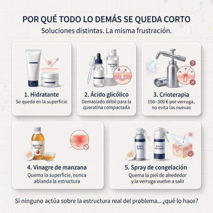 Por qué todo lo demás se queda corto