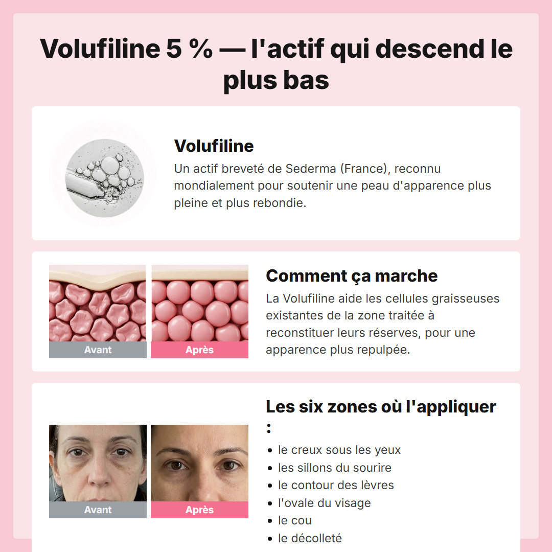 Volufiline 5 por ciento - cómo funciona y las seis zonas
