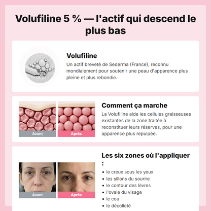 Volufiline 5 por ciento - cómo funciona y las seis zonas