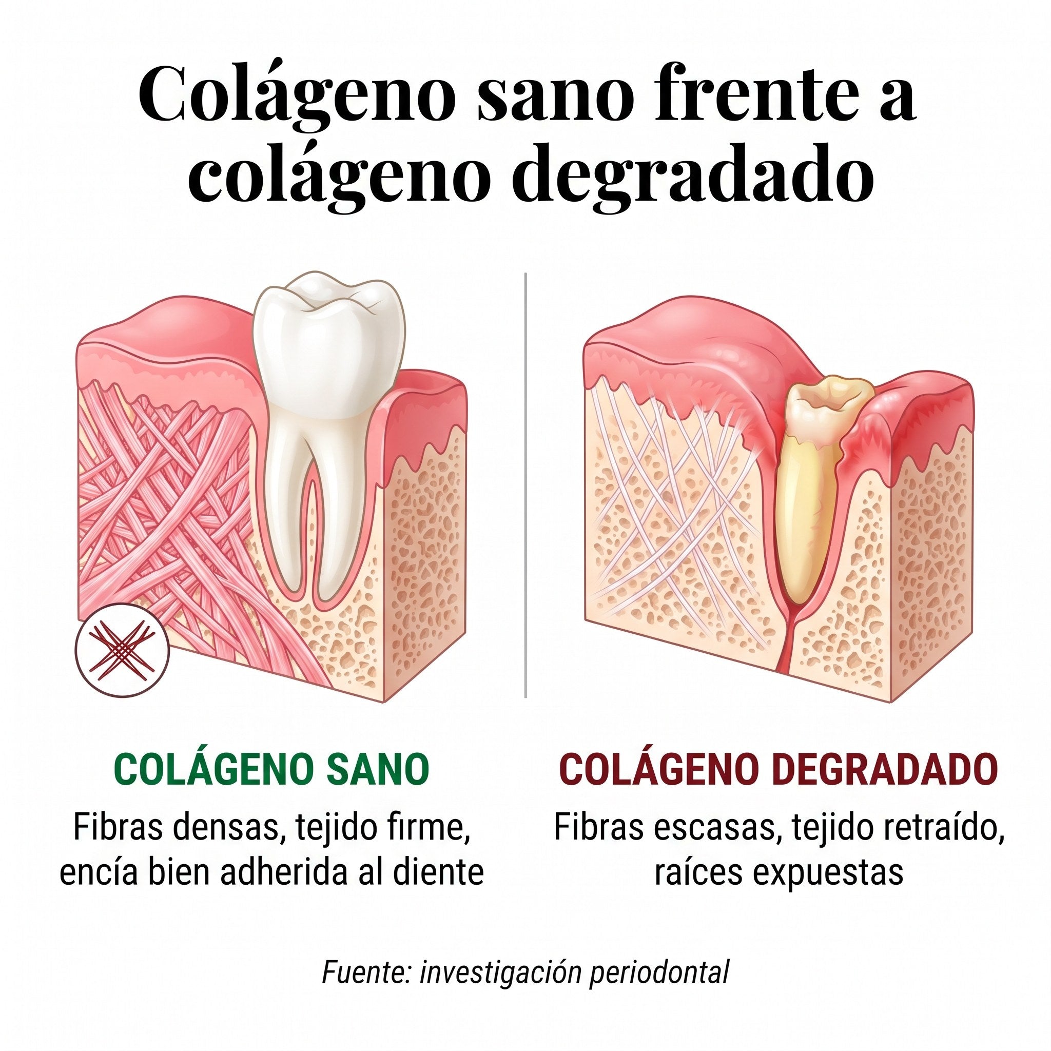 Tejido gingival sano frente a tejido con déficit de colágeno