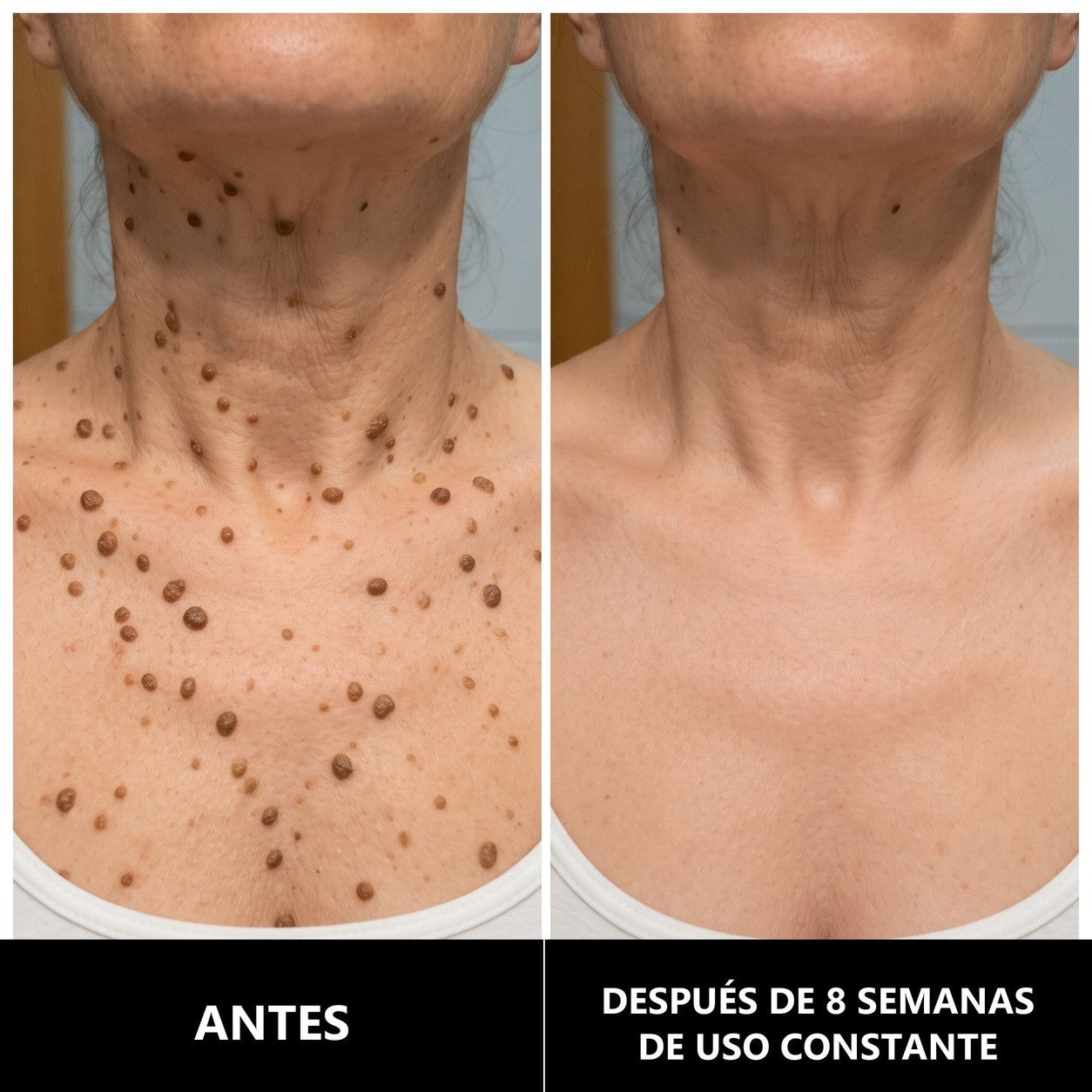 Pilar, antes y después