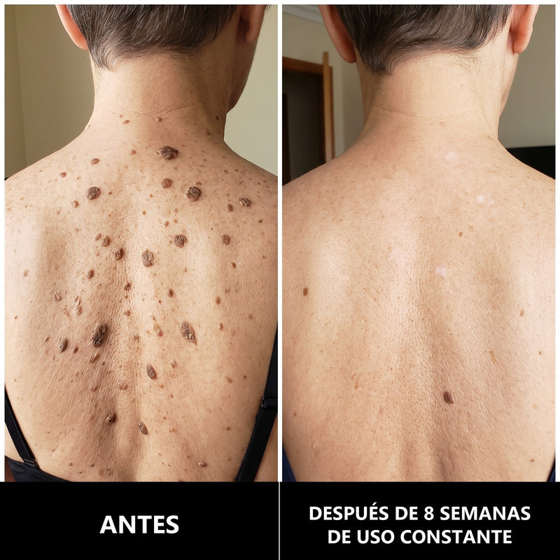 BALM Crema de Urea 40 %