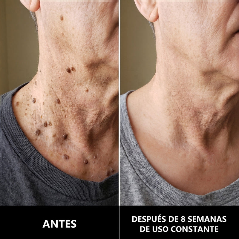 BALM Crema de Urea 40 %